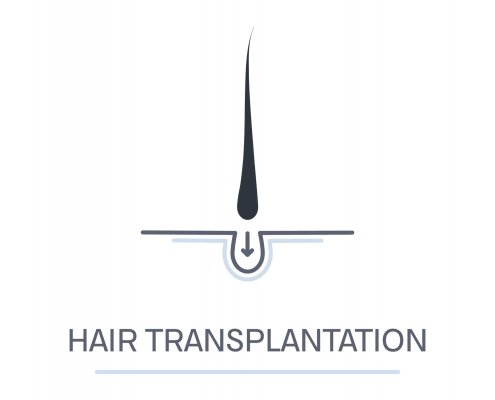 ACell Hair Transplant