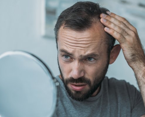 reverse hair loss