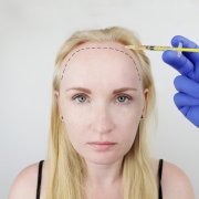 Hair Transplant Surgery