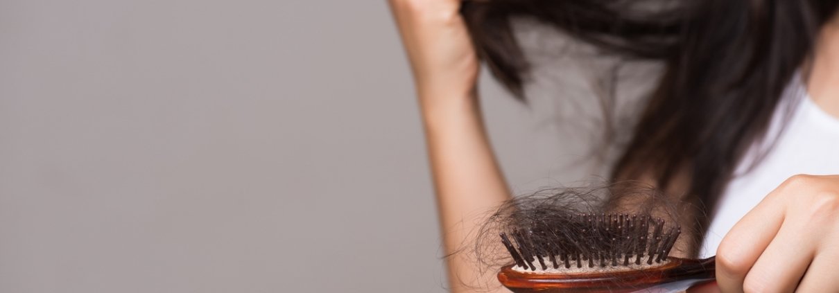 Hair Loss in Women