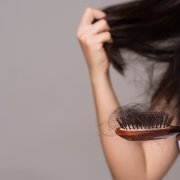 Hair Loss in Women