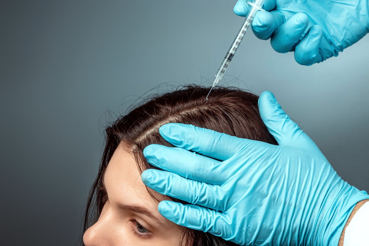 Are Stem Cell and PRP Therapy Effective for Hair Regrowth ...