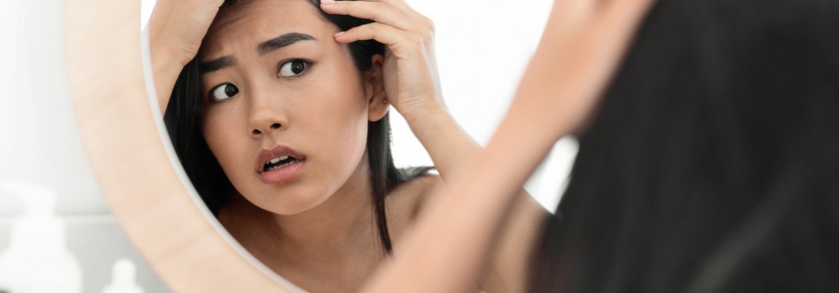 young woman suffering from hair loss