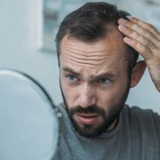 Man with hair loss