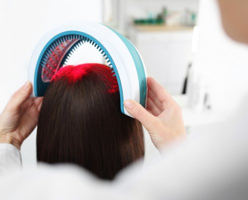 Laser therapy for scalp and hair