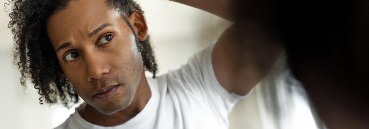 Man worried for alopecia checking hair for loss