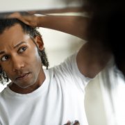 Man worried for alopecia checking hair for loss