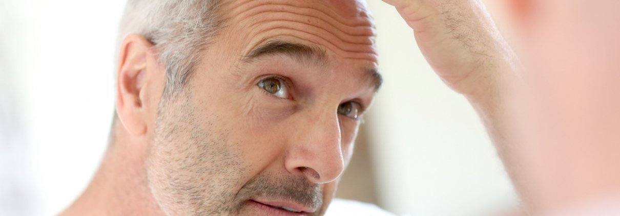 An lder man who is suffering from hair loss looking in the mirror and thinking about undergoing a FUT Treatment.