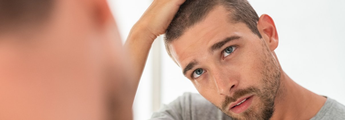 Young man looking at his hair thinning in the mirror