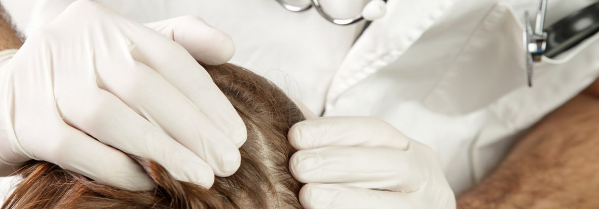 Doctor examining a patient's scalp