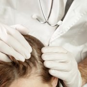 Doctor examining a patient's scalp