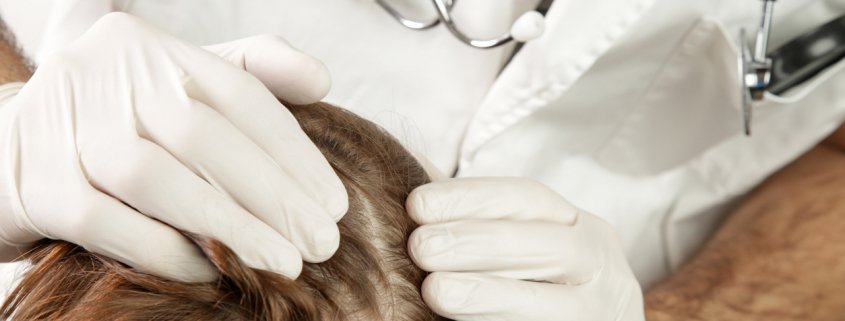 Doctor examining a patient's scalp