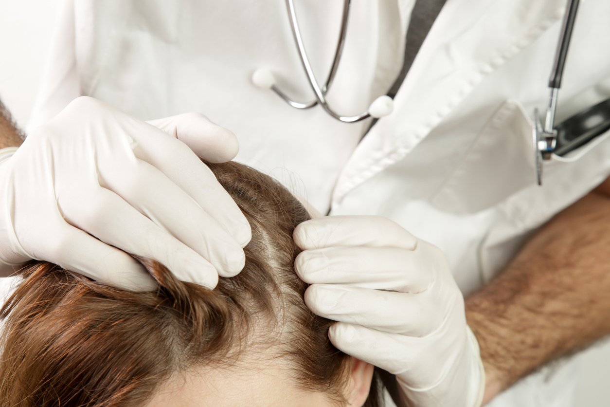How a hair loss doctor can help regain lost confidence Darling Hair