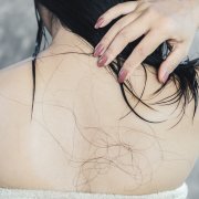 healthcare problem with hair loss falling on Asian woman back after shower