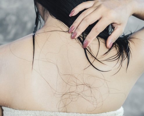 healthcare problem with hair loss falling on Asian woman back after shower