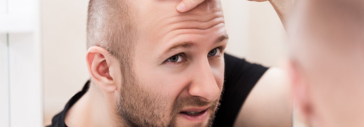 A balding man contemplating hair replacement.