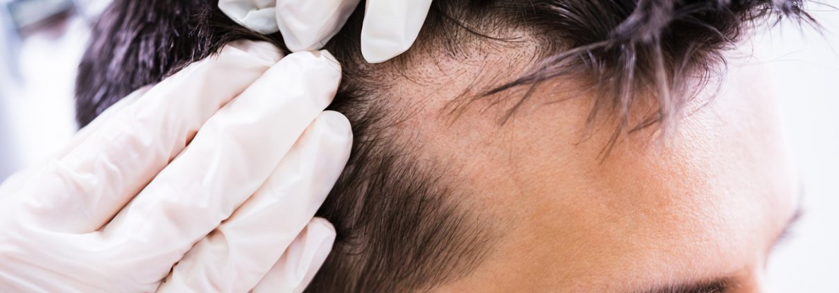 Hair Doctor Analysing Patients haIr problem