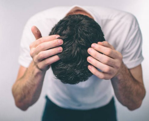 Men's hair is a top view close-up. ark-haired man Gray hair and Dandruff.