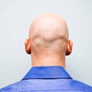 Man stands in a blue shirt facing a light blue wall showing his bald head at the camera